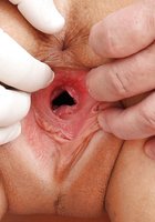 Врач осматривает вагину брюнетки стоящей раком на кушетке 7 фото