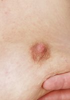 На приеме у гинеколога в старушке оказался вагинальный расширитель 2 фото